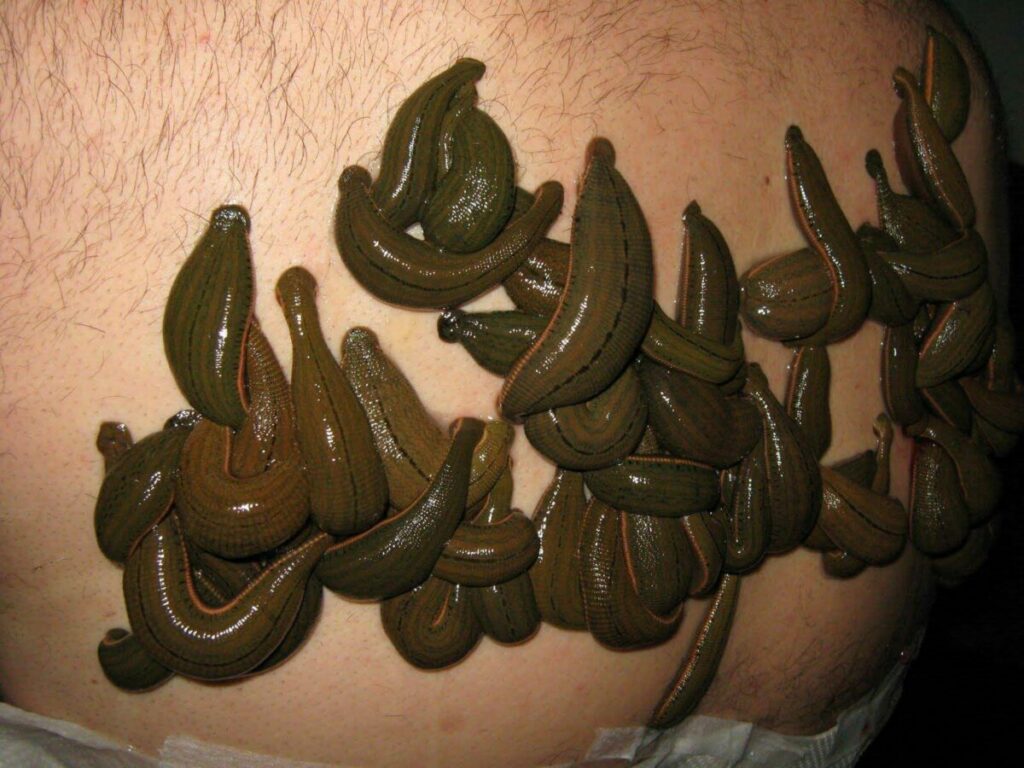 ฝันว่าปลิงเกาะเต็มตัว